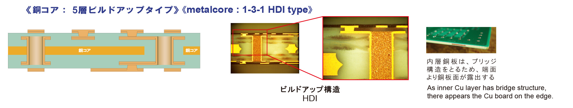 metal core: 1-3-1 HDI type